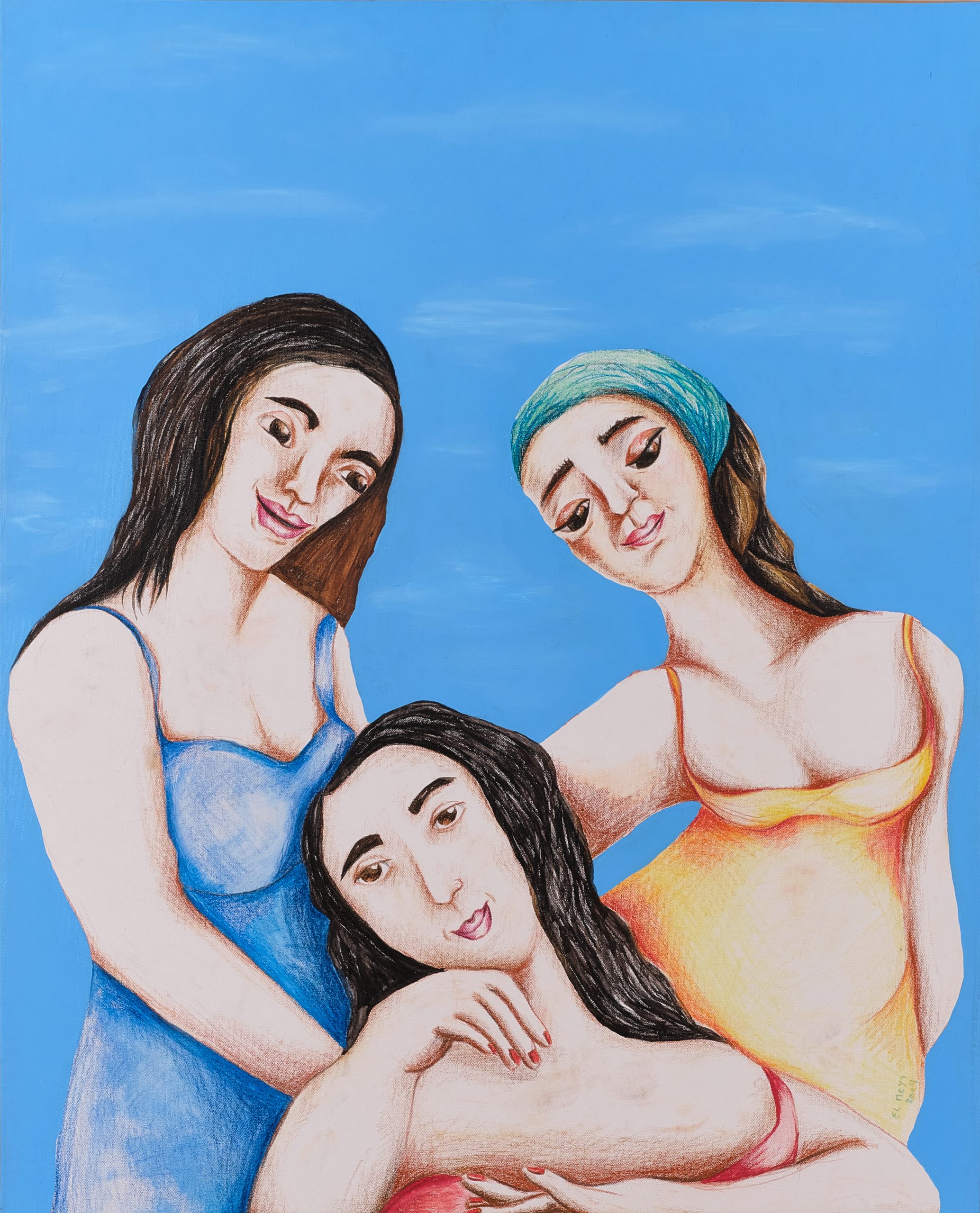 Le strabisme de venus